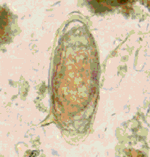 Uova di Schistosoma mansoni con la caratteristica spina laterale