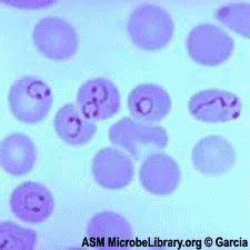 Plasmodium Vivax