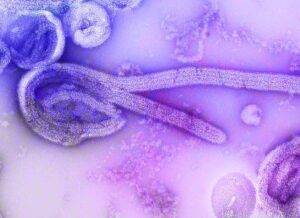 Questa è l'immagine del virus Ebola al microspoo elettronico. Per questo virus è pronto un vaccino