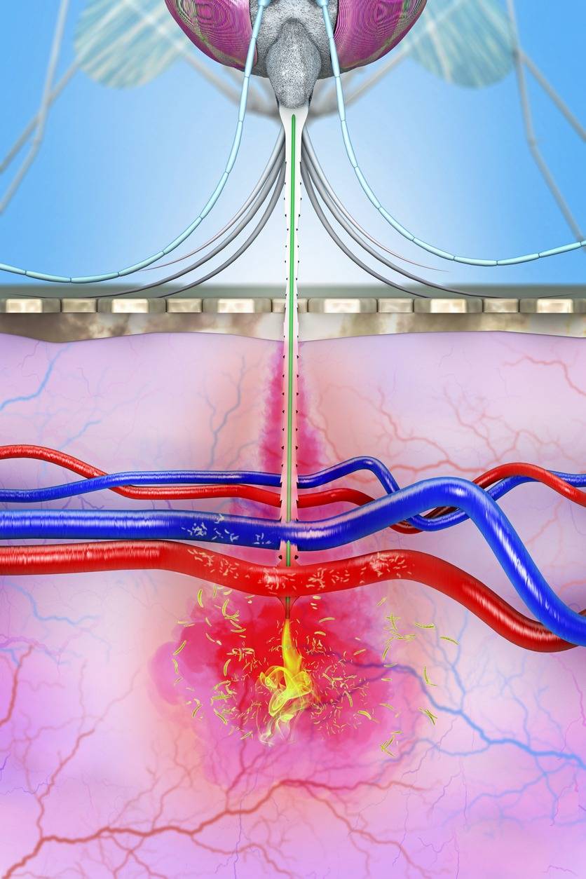 A malaria-infected mosquito transmits malaria pathogens to the human bloodstream during mosquito bites - 3D illustration