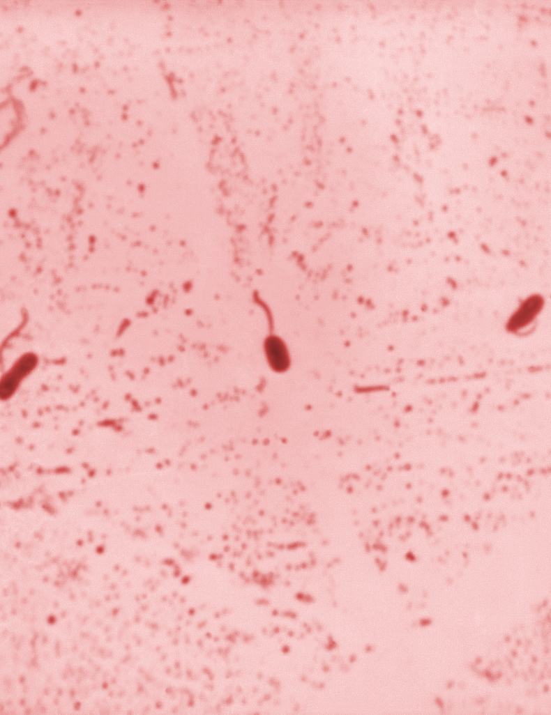 23062vibriocol